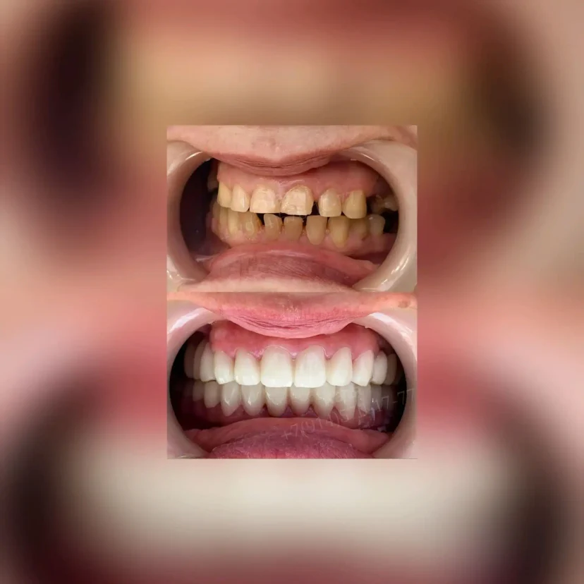 image-1