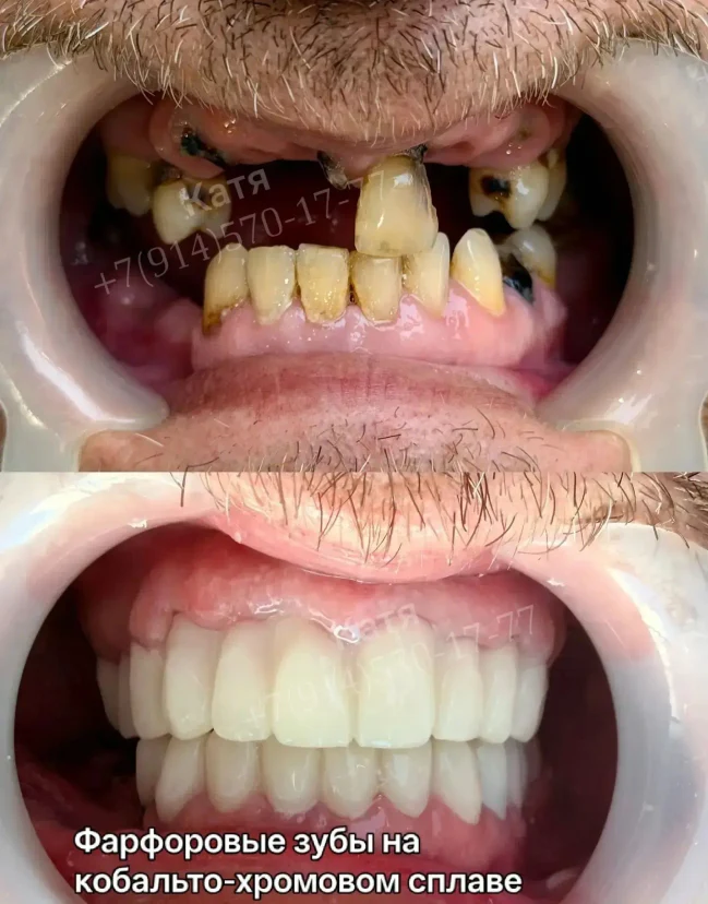 image-3