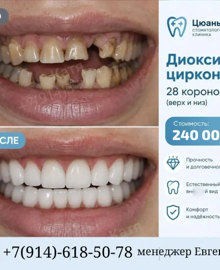 7ed82f80-b6b9-4cd9-948d-b84265d55446-i-72.webp
